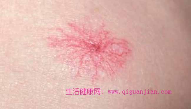 赶紧自查，身体出现这4个迹象，别等肝硬化才后悔！